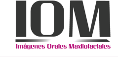 IOM